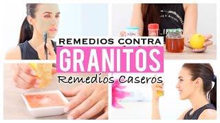 5 remedios caseros para eliminar los granitos [upl. by Cogn]