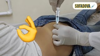 intramuscular IM shot an injection into the gluteal muscle [upl. by Wendell]