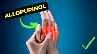 Allopurinol An Ultimate Guide To Its Uses Benefits and Side Effects [upl. by Medlin]