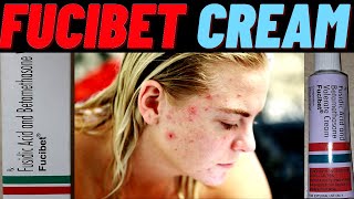 fucibet cream use in hindi how to use fucibet cream side amp effects and benefits [upl. by Ened]