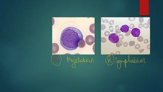 Myeloblast vs Lymphoblast mnemonic [upl. by Meehyr]