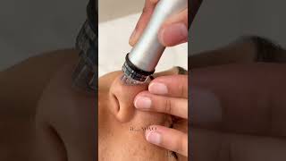 Want antiaging pore blackhead and wrinkle removal without downtime Try Cell Care Treatment 🤩 [upl. by Riamu]