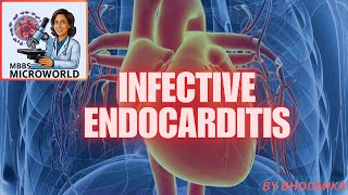 INFECTIVE ENDOCARDITIS [upl. by Adnoraj]