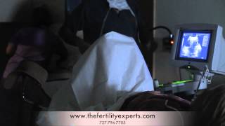 IVF Embryo Transfer [upl. by Obeng]