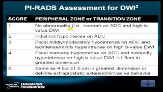 Prostate MRI Case Review A Continued Look at PI Rads [upl. by Sheya881]