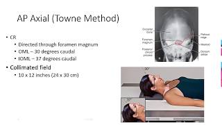 Radiographic Positioning of the Skull [upl. by Marielle]