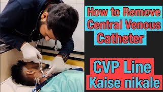 Central Line Removal viral doctor shortvideo cvp viral [upl. by Shaylyn672]