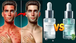 Salicylic Acid vs Glycolic Acid  Which One Is Better For Skin Health  Physiomedics [upl. by Eustacia]