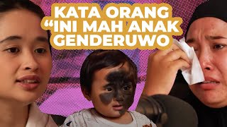 TANDA LAHIR HITAM SETENGAH MUKA ORANG BILANG ANAK GENDERUWO GritteBukaPraktek [upl. by Buffum]