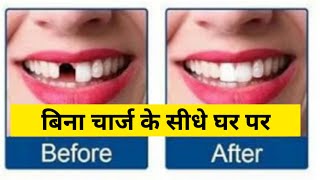 False Teeth How to Use  False Teeth  Moldable Teeth 😬 [upl. by Atirys]