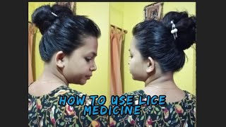 Very long hair ll How to use lice medicine ll Gamma Benzene Hexachloride Cetrimide Emulsion ascabiol [upl. by Rhonda633]