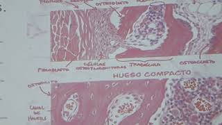 Patología osteoarticular [upl. by Neret]