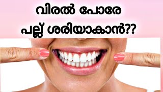 വിരൽ ഉപയോഗിച്ച നിര ശരിയാകാമോ  pallil kambi idunnath  pallil kambi idunnath malayalam  braces [upl. by Nnalorac]