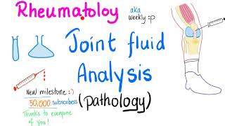 Joint fluid analysis Pathology  Joint Aspiration  Rheumatology [upl. by Bing122]