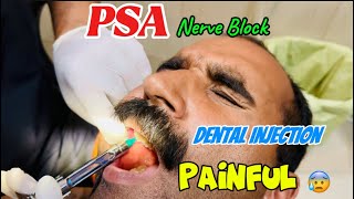 Dental injection 😬🇵🇰  How injected for PSA nerve block  pain free dentist 🦷 [upl. by Norty464]