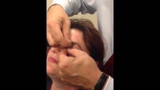 How to double evert the upper eyelid using a bent paperclip [upl. by Llaccm]