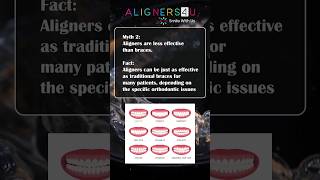 Aligners EXPOSED 3 Myths You Need to Know Myth vs fact  Clear Aligners  Braces  Hyderabad [upl. by Nonie885]