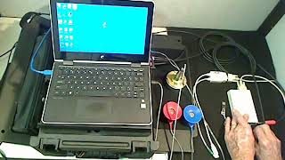 How to calibrate a Benson audiometer [upl. by Yggep]