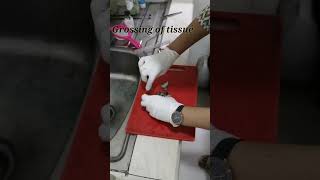 Biopsy  grossing of tissue  thyroid biopsy  thyroid tissue youtubeshorts biopsy tissue lab [upl. by Narda]