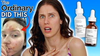 WHAT HAPPENED TO THE ORDINARYS SALICYLIC ACID VS THE NEW SALICYLIC ACID ANHYDROUS SOLUTION [upl. by Alejoa]