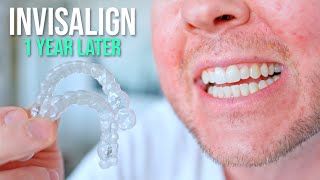 10 Things I Wish I Knew BEFORE Getting Invisalign [upl. by Awahsoj765]