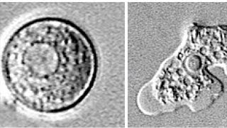 How to stay safe from the braineating amoeba [upl. by Annij]