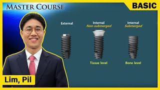 Master Course Season2  BASIC Introducing Implants [upl. by Bord302]