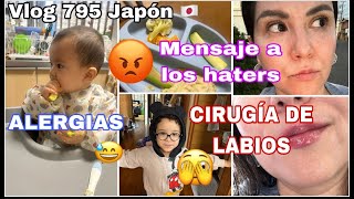 🇯🇵Mensaje a mis Hat3rs🤯ALERGIAS 😱 Cirugía de LABIOS 😅  Dimelo en mi cara 🥺 Educar desde la CALMA [upl. by Ahseid530]