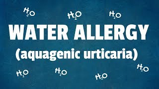 Water Allergy 10 Interesting Facts About Aquagenic Urticaria [upl. by Felicie]