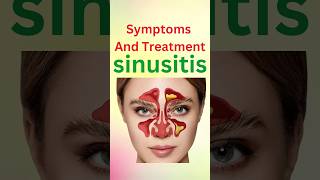 symptoms and treatment sinusitis shorts [upl. by Arataj]