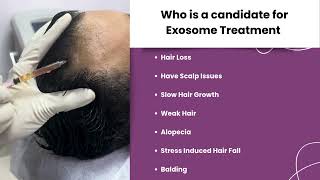 Exosome Treatment l Hair Loss l Balding l Hair Fall l Twacha l Dwarka l Delhi [upl. by Azil225]