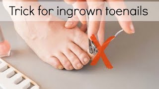 How to Fix Ingrown Toenails Easily [upl. by Nwahsit]