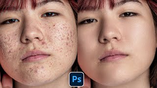 Face Retouching  Best Photoshop Tutorial  Skin Retouching 2023 [upl. by Niltak]