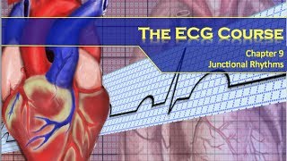 The ECG Course  Junctional Rhythms [upl. by Enylecoj6]