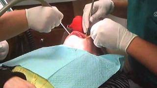 Dentist Extraction Laughing gas [upl. by Adeehsar]