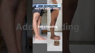 Genu recurvatum correction in Mumbai genurecurvatum bowlegs [upl. by Ymac917]