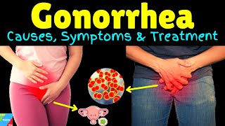 Gonorrhea – Symptoms Causes Pathophysiology Diagnosis Treatment Complications [upl. by Liebowitz]