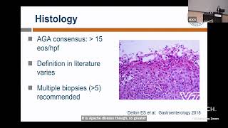 Eosinophilic Esophagitis EoE Lessons Learned from Medicaid and the UVA EoE Cohort [upl. by Soo]