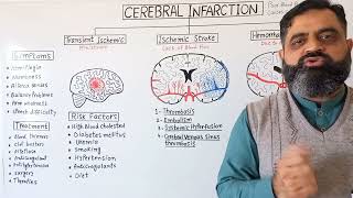 Stroke UrduHindi medium profmasoodfuzail Cerebral Infarction  Types of Stroke  Brain Stoke [upl. by Yeaton222]