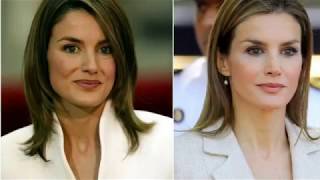 Transformación de Letizia antes y después todas las operaciones de la reina [upl. by Rehportsirhc]