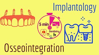 Osseointegration  Implantology  easy  lecture  5 min Dentistry [upl. by Neal]