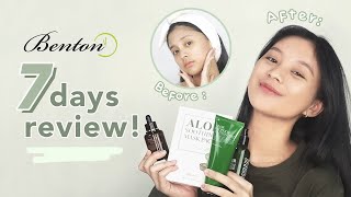 Before After with Benton  7 Days review 💚 [upl. by Adelaide]