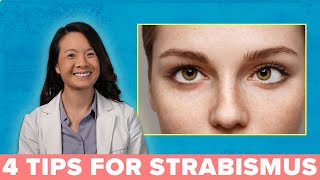 4 Great Ways to Treat Your Strabismus [upl. by Alhak77]