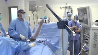 Shoulder Arthroscopy Surgery [upl. by Euqirdor]