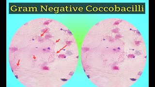 Gram Staining BAL Cytology Gram Negative Coccobacilli Fungal Staining ELearn withTechnologist [upl. by Inavoy]