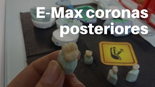 ✅ PASOS para CementaciónAdhesión Coronas EMax Posteriores👅CoronasDentales CoronasTotalPorcelana [upl. by Virg]