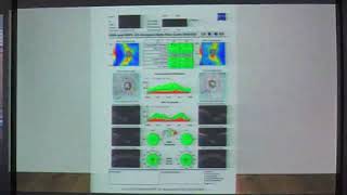 Oct in glaucoma by Dr Kamal Raafat [upl. by Etnahc902]