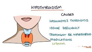 Hypothyroidism and Hashimotos Thyroiditis Visual Explanation for Students [upl. by Lanam793]