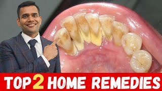 Top 2 Remedies To Remove Dental Plaque  Remove Dental Plaque and keep Oral Hygiene Healthy At Home [upl. by Jd]