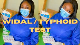 Widal test  typhoid test  Nigerian youtuber  medicallaboratoryscience widaltest typhoidfever [upl. by Jacobina]